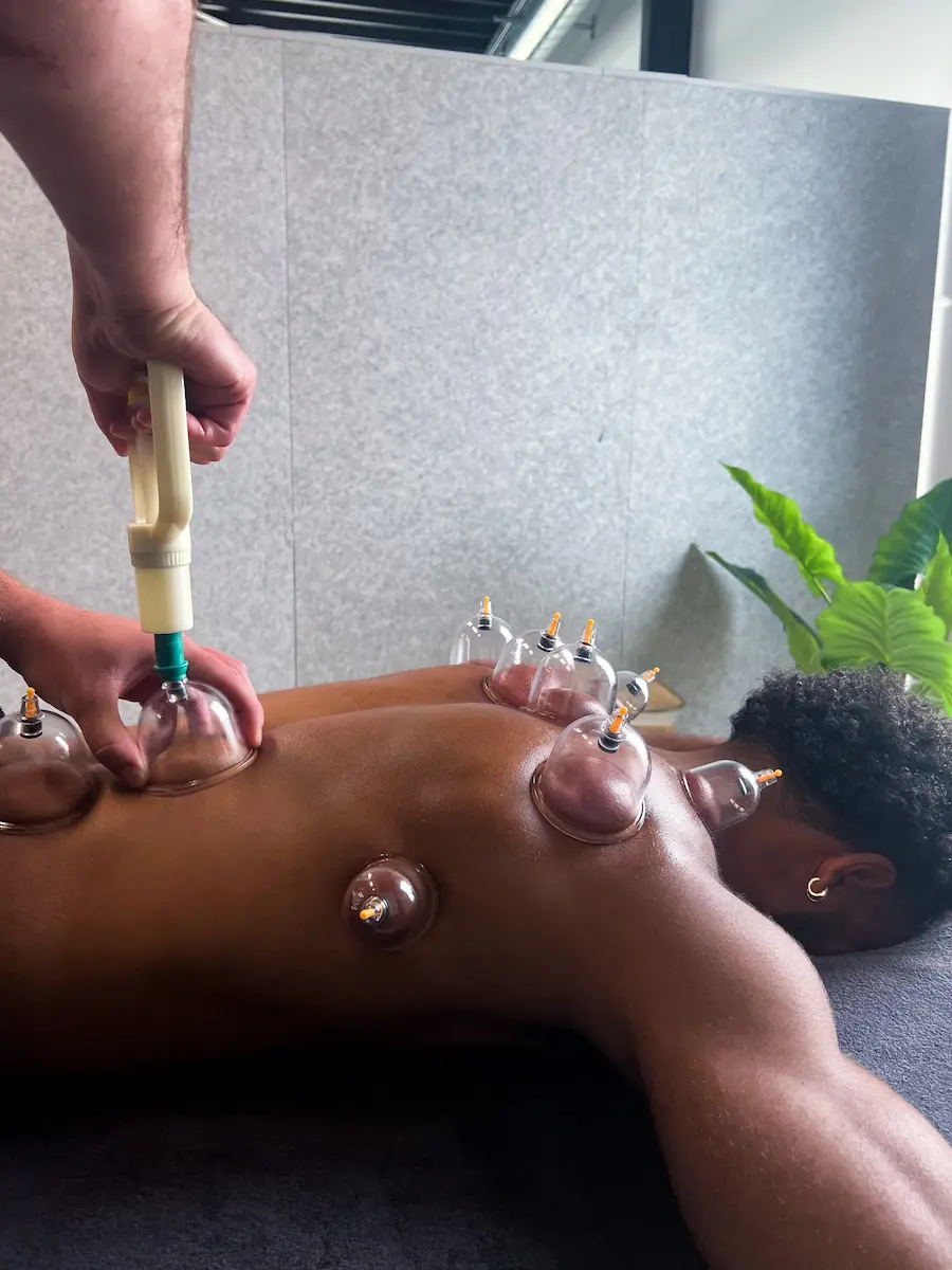 cupping-massage