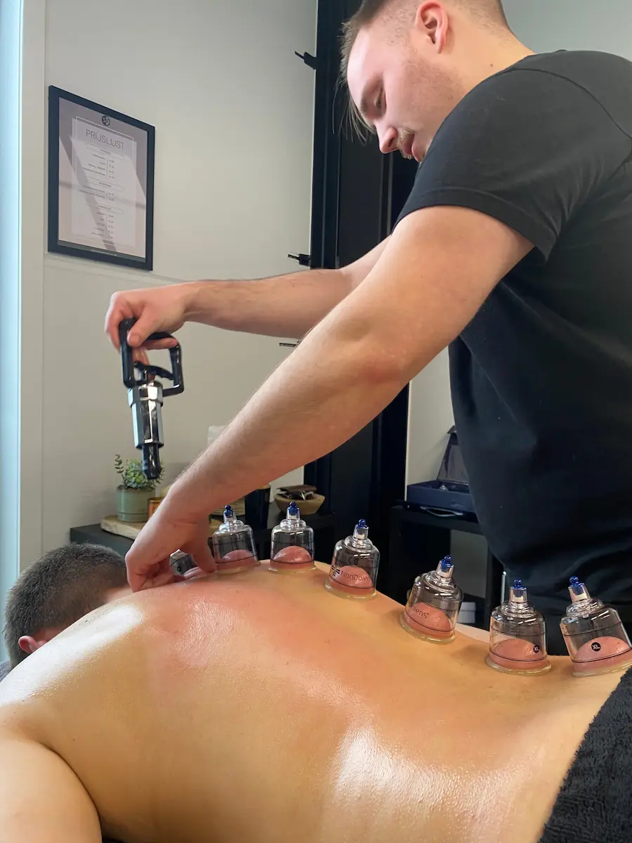 De helende kracht van Hijama De helende kracht van Hijama